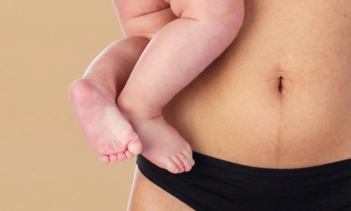 tratamiento postoperatorio pereira